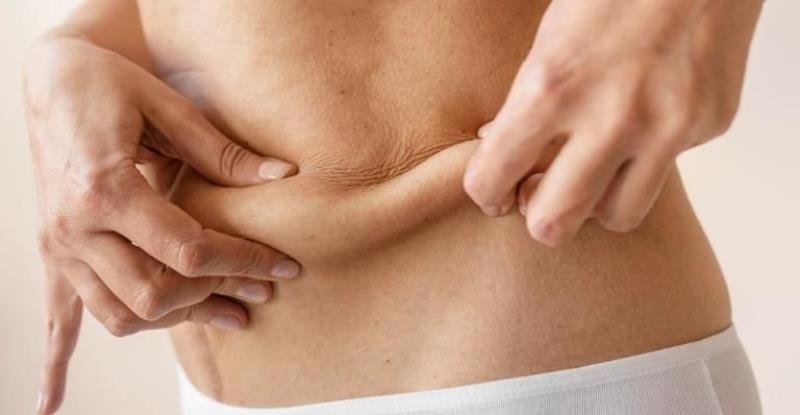  Mitos e verdades sobre flacidez abdominal