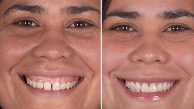  Renata Horn: Restaurando Sorrisos e Autoestima com Excelência em Implantodontia